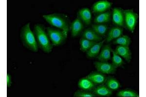 Immunofluorescent analysis of A549 cells using ABIN7168341 at dilution of 1:100 and Alexa Fluor 488-congugated AffiniPure Goat Anti-Rabbit IgG(H+L) (RBM38 antibody  (AA 1-239))