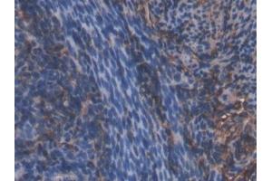 Detection of HMWK in Mouse Uterus Tissue using Polyclonal Antibody to High Molecular Weight Kininogen (HMWK) (Kininogen (HMW) antibody  (AA 268-540))