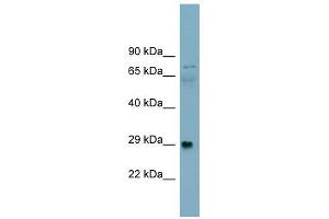 DAG1 antibody used at 1 ug/ml to detect target protein. (Dystroglycan antibody)