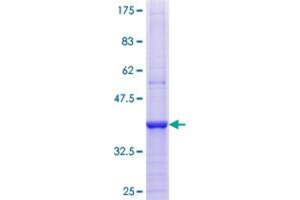 PI4KB Protein (AA 731-828) (GST tag)