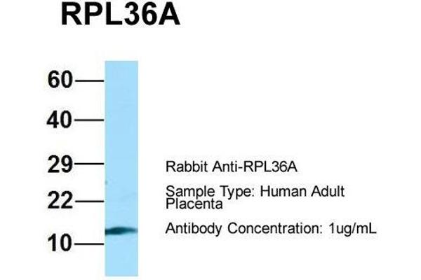 RPL36AL anticorps  (C-Term)