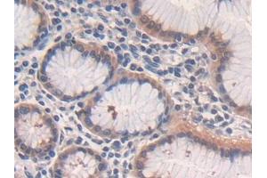 Detection of CPR in Human Stomach Tissue using Polyclonal Antibody to Cytochrome P450 Reductase (CPR)