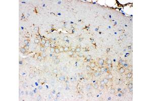 Anti-PMP70 antibody, IHC(P): Rat Brain Tissue (CX3CL1 antibody  (C-Term))