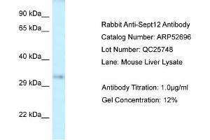 Western Blotting (WB) image for anti-Septin 12 (Sep12) (Middle Region) antibody (ABIN2785053) (Septin 12 antibody  (Middle Region))