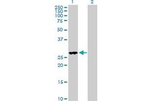 Western Blot analysis of FHL2 expression in transfected 293T cell line by FHL2 MaxPab polyclonal antibody. (FHL2 antibody  (AA 1-279))