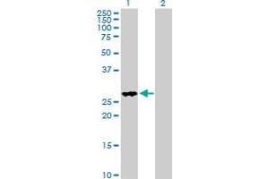 Western Blot analysis of FHL2 expression in transfected 293T cell line by FHL2 MaxPab polyclonal antibody.