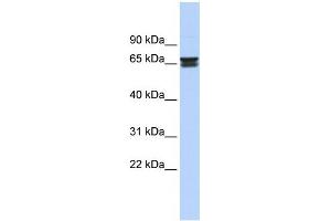 WB Suggested Anti-ZNF614 Antibody Titration:  0. (ZNF614 antibody  (Middle Region))