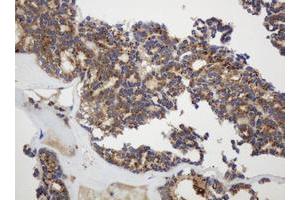 Image no. 1 for anti-Glyceraldehyde-3-Phosphate Dehydrogenase, Spermatogenic (GAPDHS) antibody (ABIN1498375) (GAPDHS antibody)