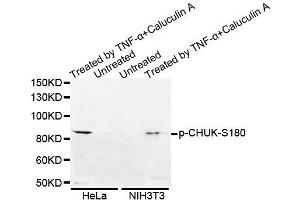 Western blot analysis of extracts of various cell lines, using Phospho-CHUK-S180 antibody (ABIN5995593). (IKK alpha antibody  (pSer180))
