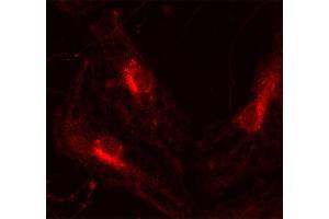 Immunocytochemistry (ICC) image for anti-VAMP (Vesicle-Associated Membrane Protein)-Associated Protein A, 33kDa (VAPA) (AA 1-223) antibody (ABIN1742504) (VAPA antibody  (AA 1-223))