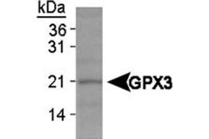 Western blot analysis of GPX3 on HeLa whole cell extracts using GPX3 polyclonal antibody . (GPX3 antibody)