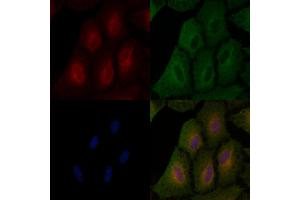 ABIN6260836 and ABIN6266727 staining  cells by IF/ICC.