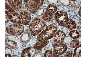 Immunohistochemical staining of paraffin-embedded Human Kidney tissue using anti-GRHPR mouse monoclonal antibody. (GRHPR antibody)