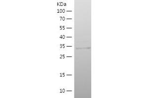 Western Blotting (WB) image for Neuritin 1 (NRN1) (AA 28-116) protein (His-IF2DI Tag) (ABIN7124143) (NRN1 Protein (AA 28-116) (His-IF2DI Tag))