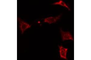 ABIN6274315 staining Hela cells by IF/ICC. (MVK antibody  (Internal Region))