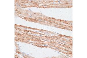 Immunohistochemistry of paraffin-embedded rat heart using GRK5 antibody (ABIN1680115, ABIN3018251, ABIN3018252 and ABIN6220413) at dilution of 1:100 (40x lens). (GRK5 antibody  (AA 371-590))