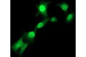 Anti-TMOD1 mouse monoclonal antibody (ABIN2454774) immunofluorescent staining of COS7 cells transiently transfected by pCMV6-ENTRY TMOD1 (RC201134). (Tropomodulin 1 antibody)