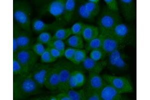 IF analysis of Ankyrin Erythroid/ANK/ANK1 using anti-Ankyrin Erythroid/ANK/ANK1 antibody (ABIN7599959). (Erythrocyte Ankyrin antibody  (AA 1300-1844))