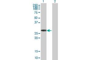 Western Blot analysis of KCNIP3 expression in transfected 293T cell line by KCNIP3 MaxPab polyclonal antibody. (DREAM antibody  (AA 1-256))