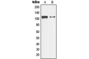 Western blot analysis of LZK expression in K562 (A), HepG2 (B) whole cell lysates. (MAP3K13 antibody  (Center))