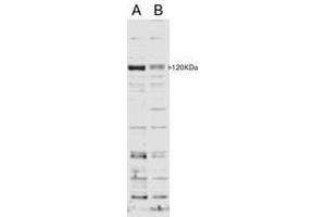 Image no. 1 for anti-SECIS Binding Protein 2 (SECISBP2) (AA 545-557) antibody (ABIN293116) (SECISBP2 antibody  (AA 545-557))