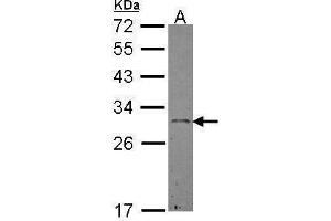 WB Image Sample (30 ug of whole cell lysate) A: Hep G2 , 12% SDS PAGE antibody diluted at 1:500 (Ephrin A3 antibody)