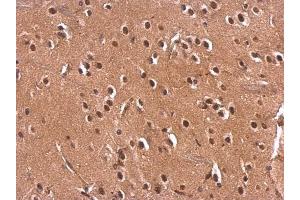 IHC-P Image Monoglyceride lipase antibody detects Monoglyceride lipase protein at nucleus on rat fore brain by immunohistochemical analysis. (MGLL antibody)