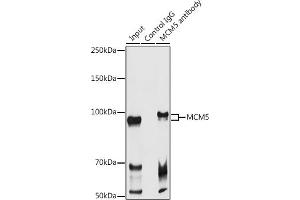 Immunoprecipitation (IP) image for anti-Minichromosome Maintenance Complex Component 5 (MCM5) (AA 1-230) antibody (ABIN6143644)