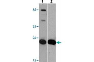 Western blot analysis of HIV-1 p24 with HIV-1 p24 monoclonal antibody  at (lane 1) 0.