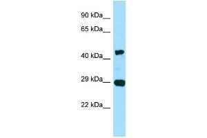 WB Suggested Anti-ACTG2 Antibody Titration: 0. (ACTG2 antibody  (C-Term))