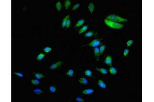 Immunofluorescent analysis of Hela cells using ABIN7145766 at dilution of 1:100 and Alexa Fluor 488-congugated AffiniPure Goat Anti-Rabbit IgG(H+L) (BCAR1 antibody  (AA 68-218))