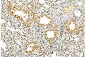 ABIN6263233 and ABIN6272850 at 1/100 staining Rat lung tissue by IHC-P. (MFF antibody  (Internal Region))