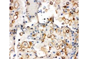 Immunohistochemistry (IHC) image for anti-Integrin alpha 1 (ITGA1) (C-Term) antibody (ABIN3031361)