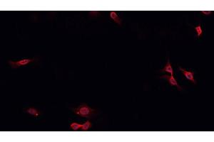 ABIN6276910 staining HepG2? (Surfactant Protein C antibody  (N-Term))