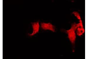 ABIN6272272 staining HuvEc by IF/ICC. (CDC16 antibody  (Internal Region))