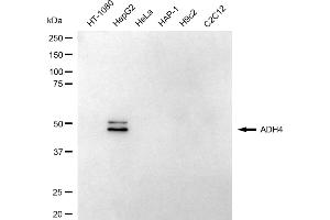 Western blotting analysis using ADH4 antibody (ABIN7797551).