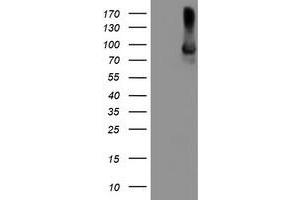 Western Blotting (WB) image for anti-Arachidonate 15-Lipoxygenase (ALOX15) antibody (ABIN1496358) (ALOX15 antibody)