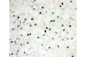 IHC analysis of EWSR1 using anti-EWSR1 antibody (ABIN3043825). (EWSR1 antibody  (Middle Region))