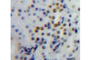 Used in DAB staining on fromalin fixed paraffin-embedded Kidney tissue (TOP2B antibody  (AA 446-655))
