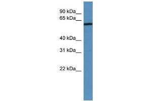 WB Suggested Anti-MAGED2 Antibody Titration: 0. (MAGED2 antibody  (N-Term))