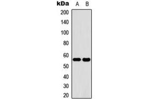 Western blot analysis of Cytochrome P450 2C19 expression in HeLa (A), human liver (B) whole cell lysates.