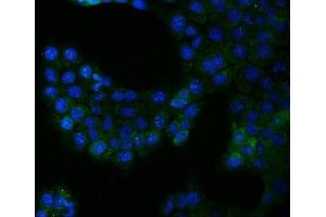 IF analysis of Bcr using anti-Bcr antibody (ABIN4886483).
