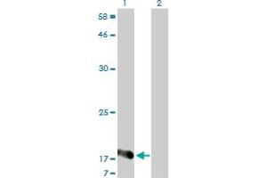 Western Blot analysis of NUDT2 expression in transfected 293T cell line by NUDT2 monoclonal antibody (M01), clone 4A4-3C3. (NUDT2 antibody  (AA 1-147))