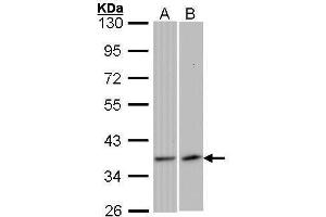 WB Image Sample (30 ug of whole cell lysate) A: 293T B: Raji 10% SDS PAGE antibody diluted at 1:1000