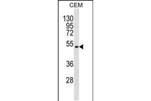 Western blot analysis in CEM cell line lysates (35ug/lane). (TOM1L2 antibody  (C-Term))