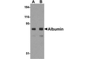 Western blot analysis of Albumin in mouse liver tissue lysate with Albumin antibody at (A) 1 and (B) 2 μg/ml. (Albumin antibody  (Center))
