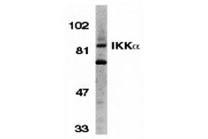 Western Blotting (WB) image for anti-conserved Helix-Loop-Helix Ubiquitous Kinase (CHUK) antibody (ABIN1030208) (IKK alpha antibody)