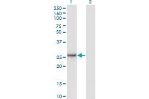 Western Blot analysis of NNMT expression in transfected 293T cell line by NNMT monoclonal antibody (M03), clone 2F2. (NNMT antibody  (AA 1-264))