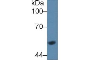 Western Blot; Sample: Rat Liver lysate; Primary Ab: 1µg/ml Rabbit Anti-Rat GCK Antibody Second Ab: 0. (GCK antibody  (AA 194-410))