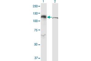 Western Blot analysis of IPO5 expression in transfected 293T cell line by RANBP5 monoclonal antibody (M01), clone 1C4. (Importin 5 antibody  (AA 1-100))
